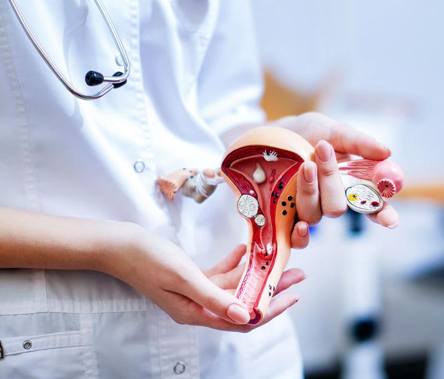 Hemorragie post partum